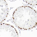 WT1 Antibody in Immunohistochemistry (Paraffin) (IHC (P))