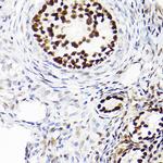 WT1 Antibody in Immunohistochemistry (Paraffin) (IHC (P))