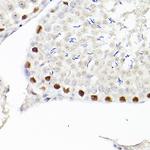 WT1 Antibody in Immunohistochemistry (Paraffin) (IHC (P))