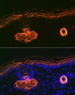 Cytokeratin 2e Antibody in Immunohistochemistry (Paraffin) (IHC (P))