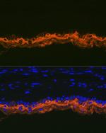 Cytokeratin 2e Antibody in Immunohistochemistry (Paraffin) (IHC (P))