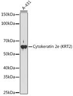 Cytokeratin 2e Antibody in Western Blot (WB)