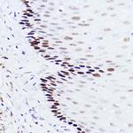 p73 Antibody in Immunohistochemistry (Paraffin) (IHC (P))