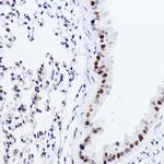 p73 Antibody in Immunohistochemistry (Paraffin) (IHC (P))