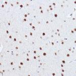 p73 Antibody in Immunohistochemistry (Paraffin) (IHC (P))