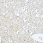 TrkA/TrkB/TrkC Antibody in Immunohistochemistry (Paraffin) (IHC (P))