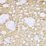 TrkA/TrkB/TrkC Antibody in Immunohistochemistry (Paraffin) (IHC (P))