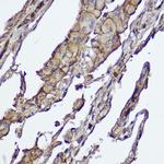 AKT1/AKT2 Antibody in Immunohistochemistry (Paraffin) (IHC (P))