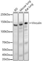 Vinculin Antibody in Western Blot (WB)