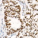 SMARCB1 Antibody in Immunohistochemistry (Paraffin) (IHC (P))