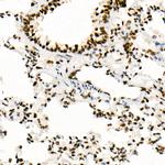 SMARCB1 Antibody in Immunohistochemistry (Paraffin) (IHC (P))