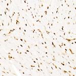 SMARCB1 Antibody in Immunohistochemistry (Paraffin) (IHC (P))