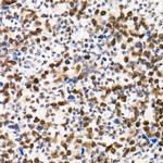 SMARCB1 Antibody in Immunohistochemistry (Paraffin) (IHC (P))