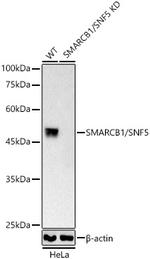 SMARCB1 Antibody in Western Blot (WB)