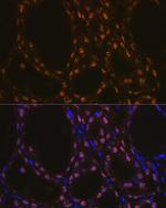 Nkx2.1 Antibody in Immunohistochemistry (Paraffin) (IHC (P))