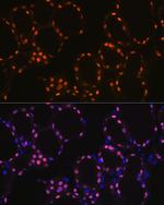 Nkx2.1 Antibody in Immunohistochemistry (Paraffin) (IHC (P))