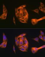 TAB1 Antibody in Immunocytochemistry (ICC/IF)