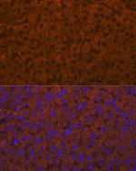 ADAMTS13 Antibody in Immunohistochemistry (Paraffin) (IHC (P))