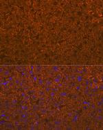 ADAMTS13 Antibody in Immunohistochemistry (Paraffin) (IHC (P))