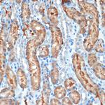 MUC4 Antibody in Immunohistochemistry (Paraffin) (IHC (P))