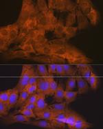 TBK1 Antibody in Immunocytochemistry (ICC/IF)