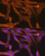 TBK1 Antibody in Immunocytochemistry (ICC/IF)