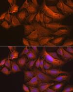 TBK1 Antibody in Immunocytochemistry (ICC/IF)