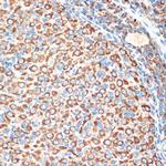 SLIT2 Antibody in Immunohistochemistry (Paraffin) (IHC (P))