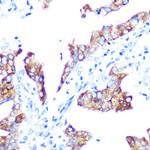 IGF2BP3 Antibody in Immunohistochemistry (Paraffin) (IHC (P))