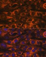 YBX1 Antibody in Immunocytochemistry (ICC/IF)