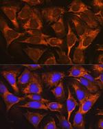 YBX1 Antibody in Immunocytochemistry (ICC/IF)