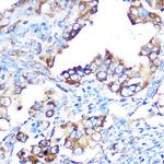 YBX1 Antibody in Immunohistochemistry (Paraffin) (IHC (P))