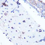 YBX1 Antibody in Immunohistochemistry (Paraffin) (IHC (P))