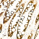 COX2 Antibody in Immunohistochemistry (Paraffin) (IHC (P))