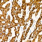 COX2 Antibody in Immunohistochemistry (Paraffin) (IHC (P))