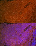 SHIP1 Antibody in Immunohistochemistry (Paraffin) (IHC (P))