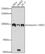 ODF2 Antibody in Western Blot (WB)