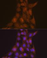 LIS1 Antibody in Immunocytochemistry (ICC/IF)