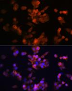 LXR alpha Antibody in Immunocytochemistry (ICC/IF)