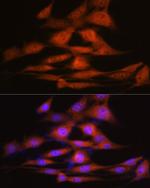 LXR alpha Antibody in Immunocytochemistry (ICC/IF)