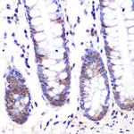 LXR alpha Antibody in Immunohistochemistry (Paraffin) (IHC (P))