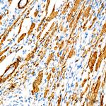 MYH11 Antibody in Immunohistochemistry (Paraffin) (IHC (P))