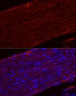 MYH11 Antibody in Immunohistochemistry (Paraffin) (IHC (P))