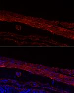 MYH11 Antibody in Immunohistochemistry (Paraffin) (IHC (P))