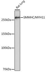 MYH11 Antibody in Western Blot (WB)