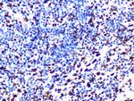 SAMHD1 Antibody in Immunohistochemistry (Paraffin) (IHC (P))