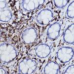 L-Plastin Antibody in Immunohistochemistry (Paraffin) (IHC (P))