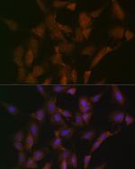 DISC1 Antibody in Immunocytochemistry (ICC/IF)