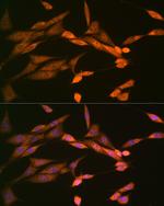 DISC1 Antibody in Immunocytochemistry (ICC/IF)