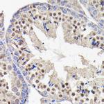 PIK3R2 Antibody in Immunohistochemistry (Paraffin) (IHC (P))